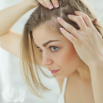 Hair Transplantation for Women